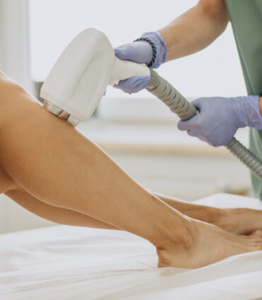 LASER HAIR REMOVAL IN LONDON